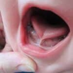 Desmantelándo mitos: cómo identificar situaciones de riesgo en situación de atragantamiento por la lengua y qué medidas tomar