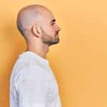 Calvicie hereditaria: ¿se transmite de la madre o del padre?