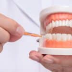 Uso correcto de cepillos interdentales