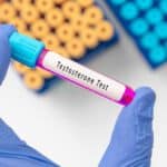 Chip hormonal para mujeres: descubre sus beneficios rejuvenecedores