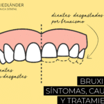 ¿Cómo saber si tienes bruxismo? Aprende a identificarlo y prevenirlo