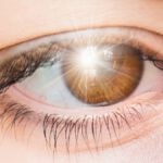 Flashes Blancos en los Ojos: ¿Cuándo Consultar al Médico?