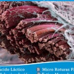 Dolor muscular: agujetas al microscopio