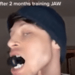 Ejercitar mandíbula: los riesgos virales de TikTok