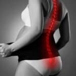 Impacto de la hernia discal en el embarazo
