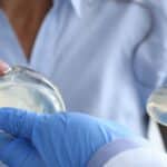 Implantes de mama: ¿Cuándo es necesario cambiarlos?