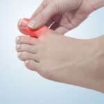 Manchas en los pies: señales de alerta sobre tu salud