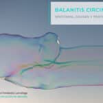 Tratamientos para la balanitis circinada y grietas en el prepucio